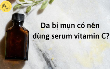 Bị mụn có nên dùng serum vitamin C