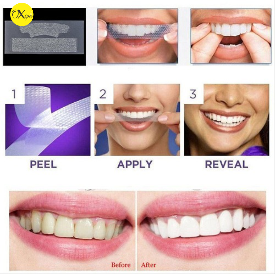Các sản phẩm dán trắng răng phổ biến hiện nay.
